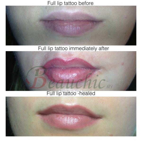 Lip Embroidery by Professional - Doorstep - Image 3
