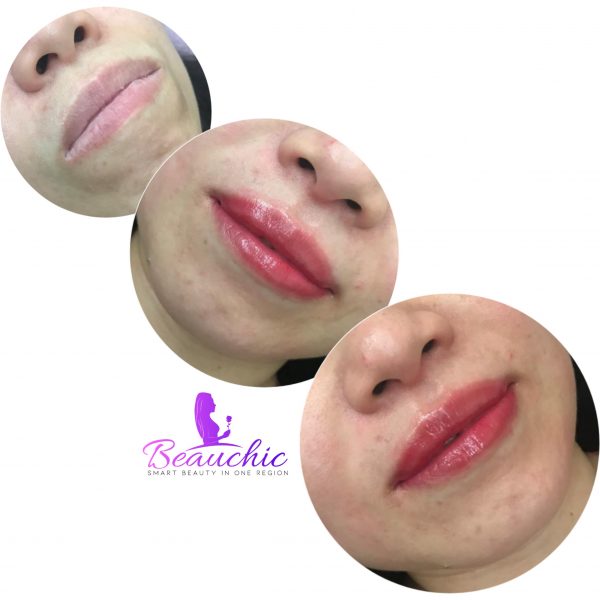 Lip Embroidery by Professional - Doorstep - Image 6